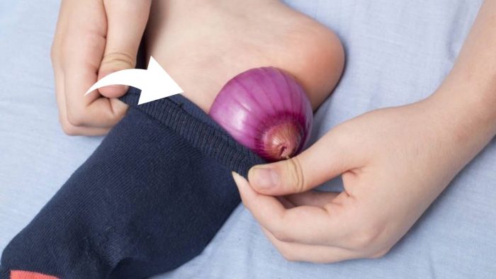Metti 1 fetta di cipolla nei calzini prima di dormire: il vecchio rimedio dei nonni